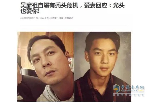 昔日男神已有禿頭危機